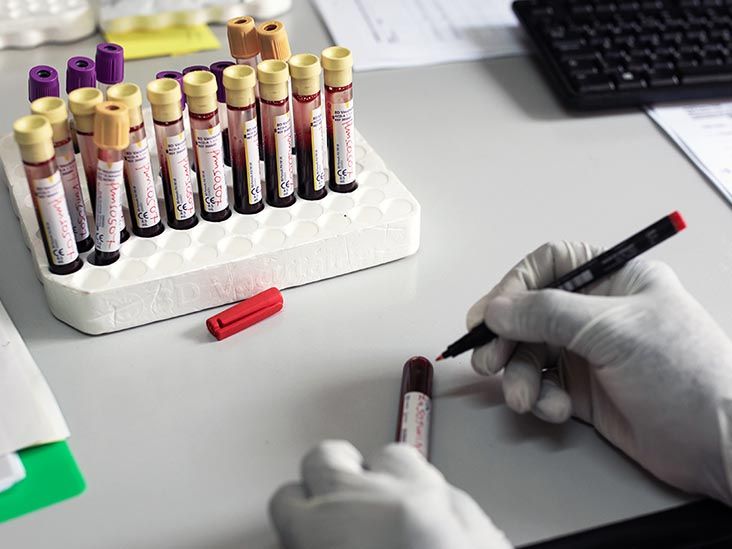 ¿Por qué están aumentando los casos de infecciones por VIH entre las niñas?