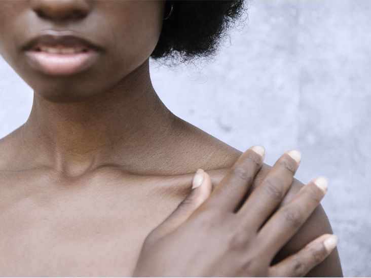 Vitamina B12 podría impulsar la reparación de tejidos y ayudar a tratar la colitis ulcerosa