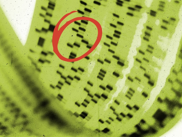 ¿Podría una nueva terapia genética ayudar a revertir el Alzheimer?