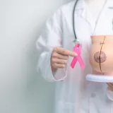 Más del 95 % de los casos de cáncer de mama no es hereditario