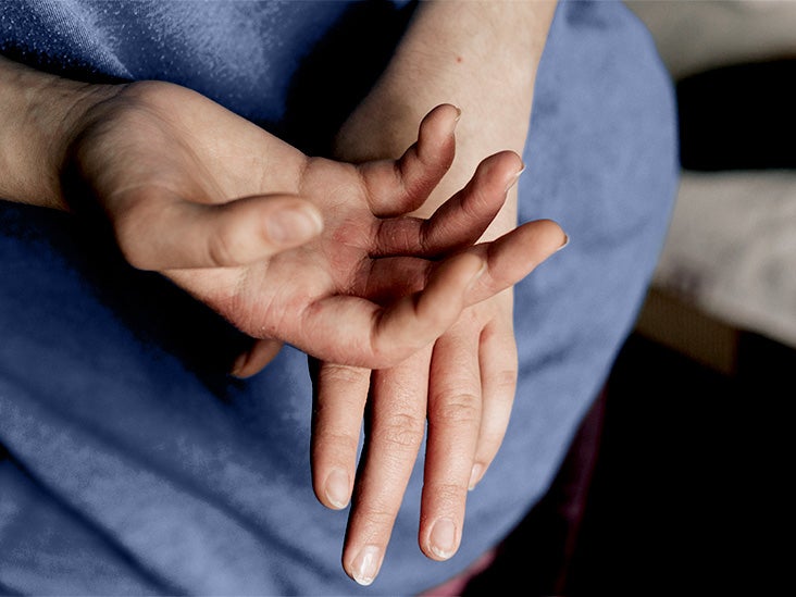 Eczema en bebés: Científicos afirman que un biomarcador cutáneo puede ayudar a predecir la dermatitis atópica