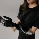 Primer plano de una mujer ajustando su prótesis biónica de última generación, que muestra un diseño innovador.