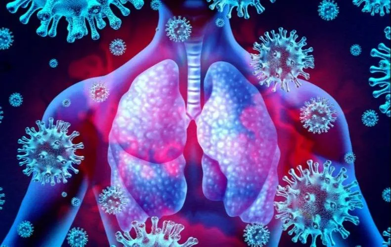 Infectóloga pide calma por caso de peste neumónica en Rusia