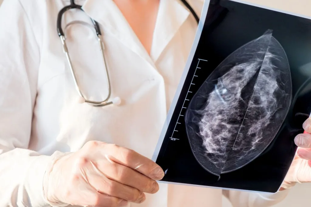 Senos Ayuda reporta 40% más atenciones por cáncer de mama