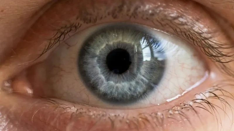 Extraen clavo de 35 milímetros del ojo de un paciente