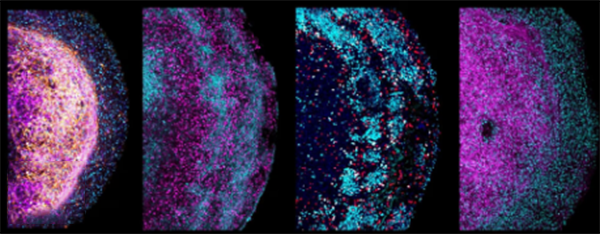 Crean ‘minicerebros’ a partir del tejido cerebral de fetos