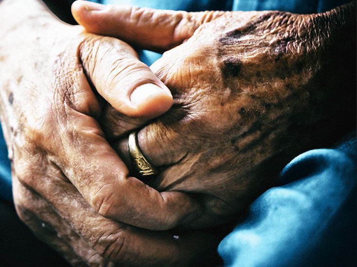 ¿Podrían las estatinas ayudar a frenar el desarrollo de síntomas de demencia?