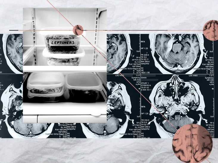 El aumento de peso después de una dieta: Cambio en la señalización de las neuronas del hambre puede ofrecer una explicación
