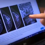 Chequeo a tiempo reduce retraso en diagnóstico de cáncer de mama