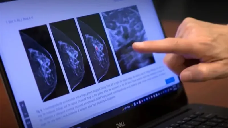 Chequeo a tiempo reduce retraso en diagnóstico de cáncer de mama