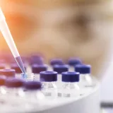 Investigan prueba de orina para detectar cáncer de vejiga