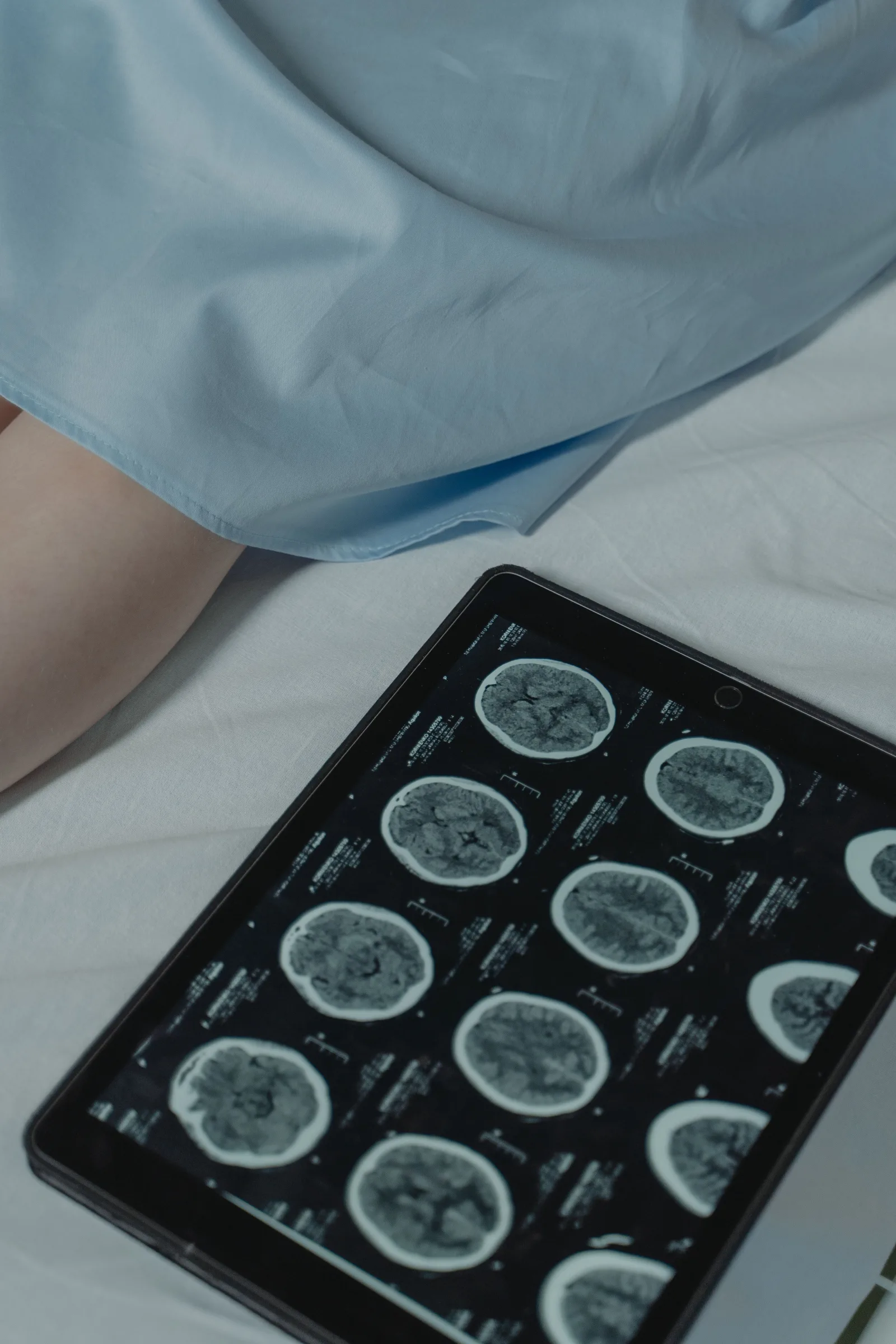 Primer plano de una tableta digital que muestra escáneres cerebrales junto a un paciente en un entorno hospitalario.