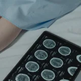 Primer plano de una tableta digital que muestra escáneres cerebrales junto a un paciente en un entorno hospitalario.