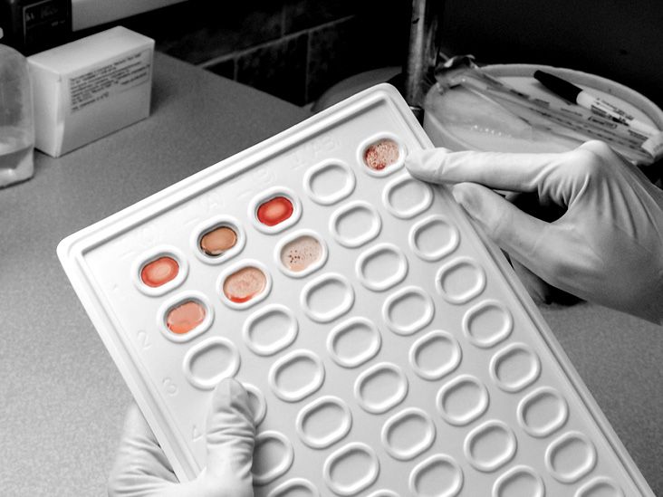 Nueva prueba de sangre promete detectar 18 tipos de cáncer