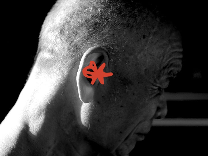 Tecnología ponible similar a auriculares podría ayudar a identificar Alzheimer y Parkinson