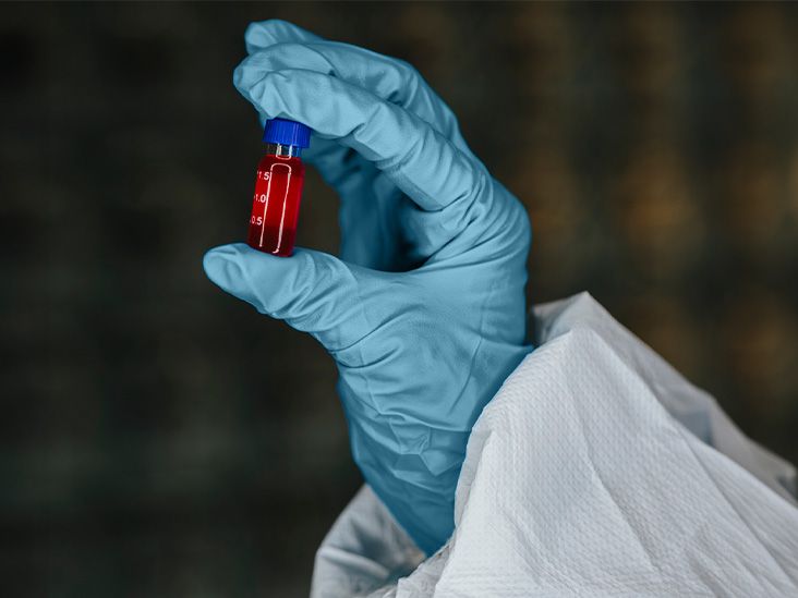 Nuevo test sanguíneo experimental puede detectar la enfermedad de Parkinson antes de la aparición de síntomas