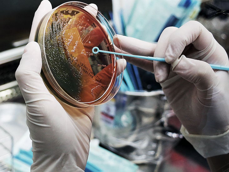 Toxina de las bacterias intestinales puede desencadenar el inicio y recaída de esclerosis múltiple