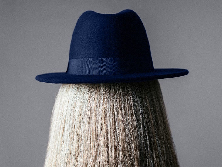 ¿El cabello se está volviendo gris? Los científicos dicen que una «falla» en las células madre puede ser la causa