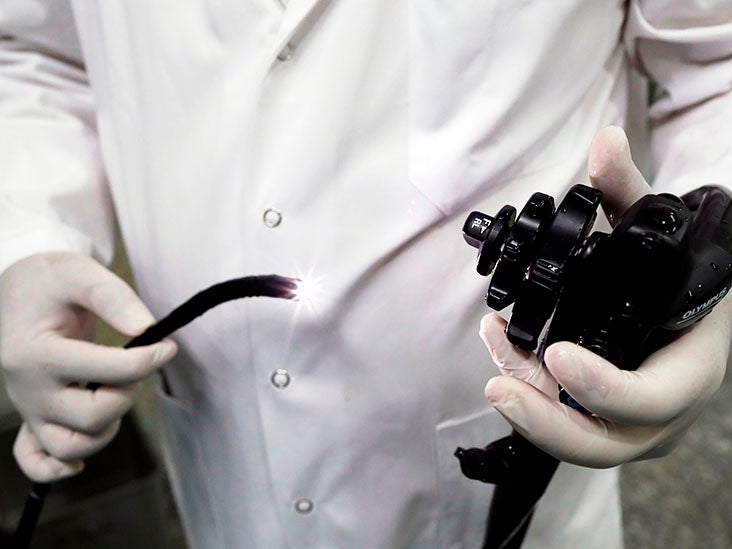 Procedimiento endoscópico de una hora podría eliminar la necesidad de insulina para la diabetes tipo 2
