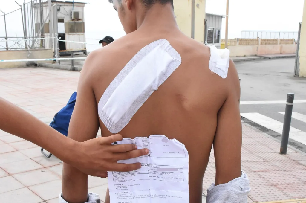 Once militares han sufrido heridas en choques en Ceuta
