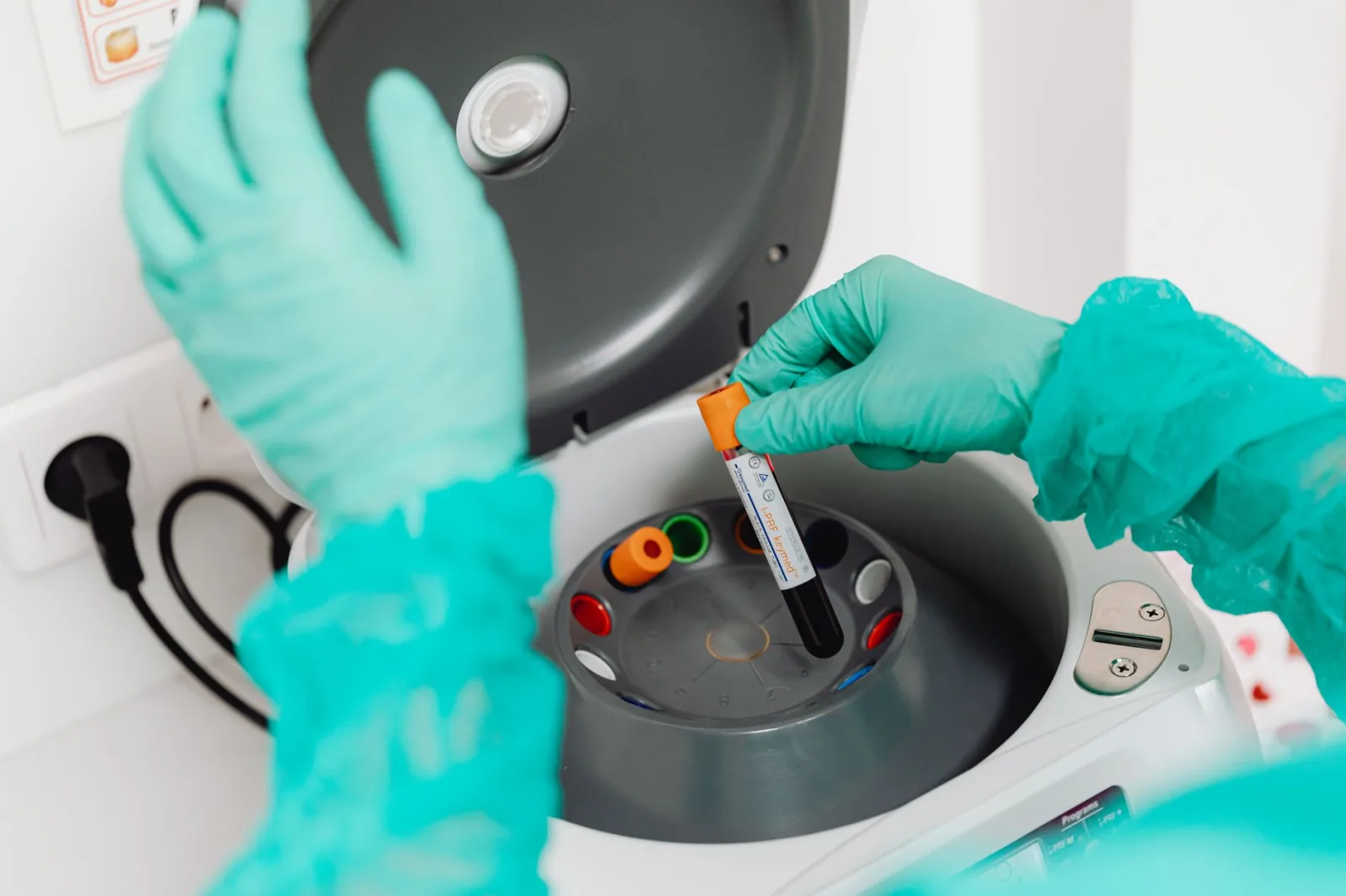 Un técnico de laboratorio con guantes utiliza una centrífuga para analizar sangre en un laboratorio moderno.