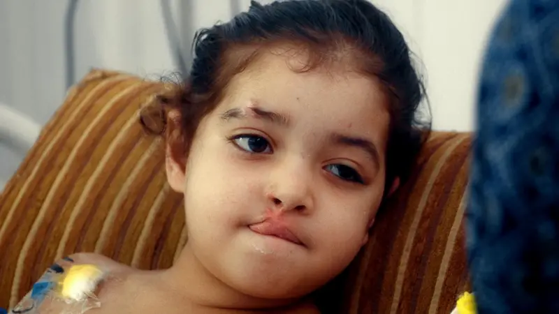 Gaza enfrenta infecciones resistentes y una niña grave
