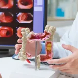 Hallan pistas en el microbioma sobre cánceres antes de los 50 años